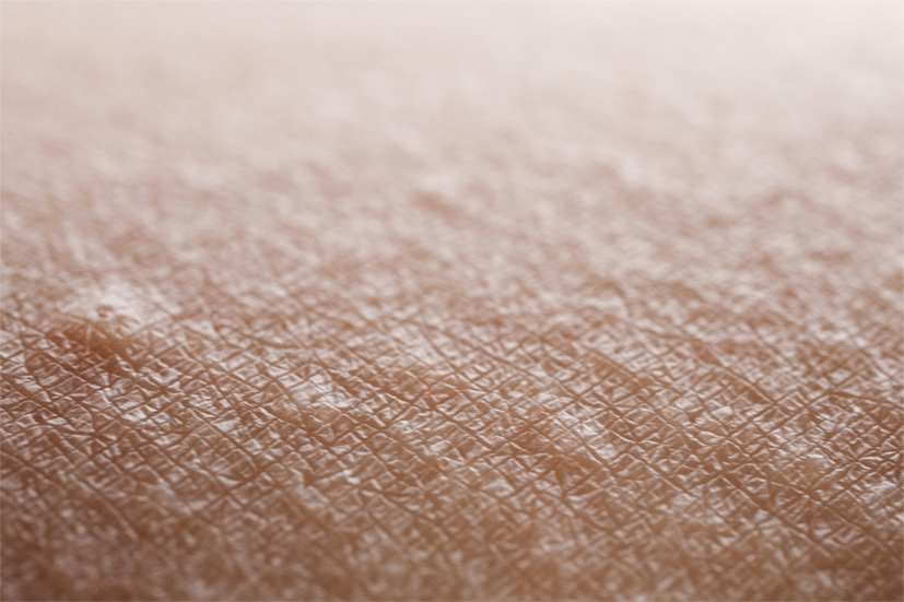 erstefoto03